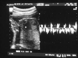 [Sonogram]