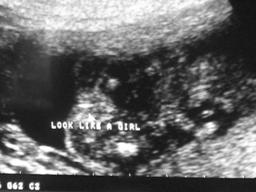 [Sonogram]